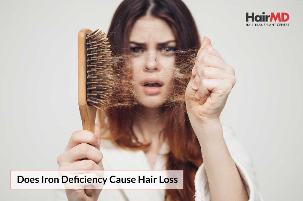 The List Of 20 Iron Deficiency Hair Loss Early Stage Female Pattern