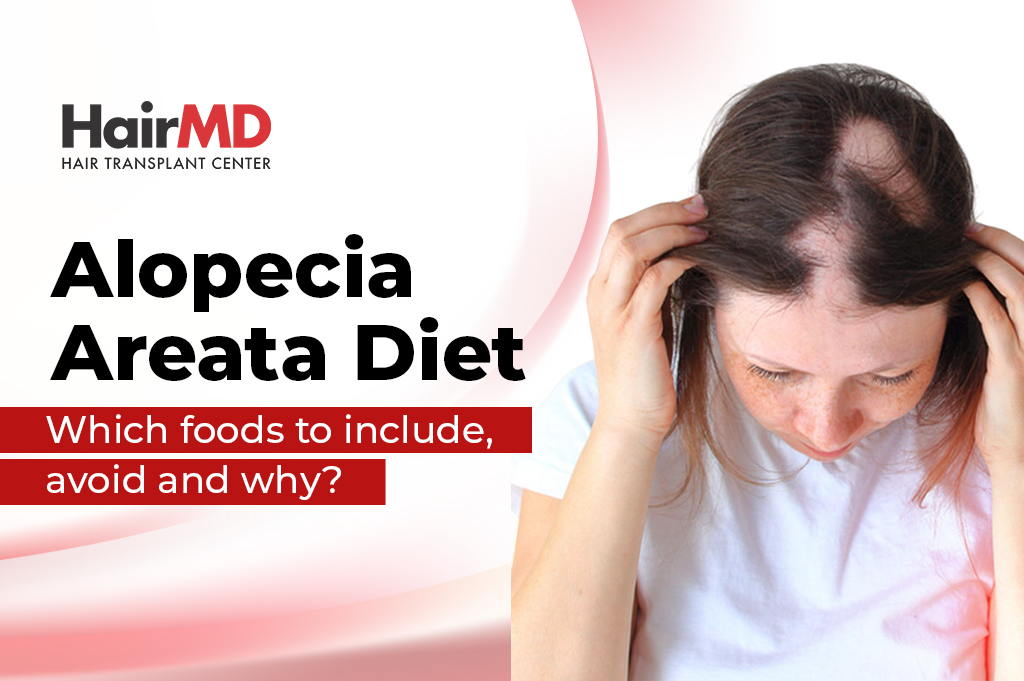 Alopecia Areata Diet Which foods to include, avoid and why