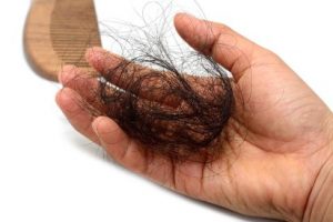 Hair Loss in Women Over 40: Causes and Treatments