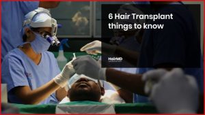 6 Hair Transplant Things To Know