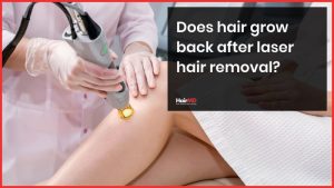 Does hair grow back after laser hair removal hairmd