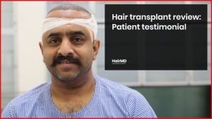 Hair transplant review Patient testimonial