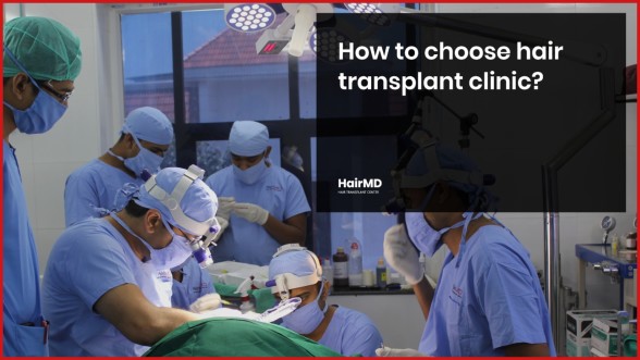 How to Choose Best Hair Transplant Clinic? - by kabera Global - Medium