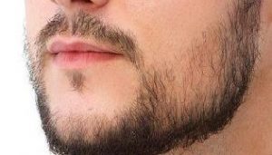 weak beard growth