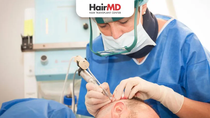 What questions to Ask Your Hair Transplant Surgeon? Expert Advice for a Successful Procedure