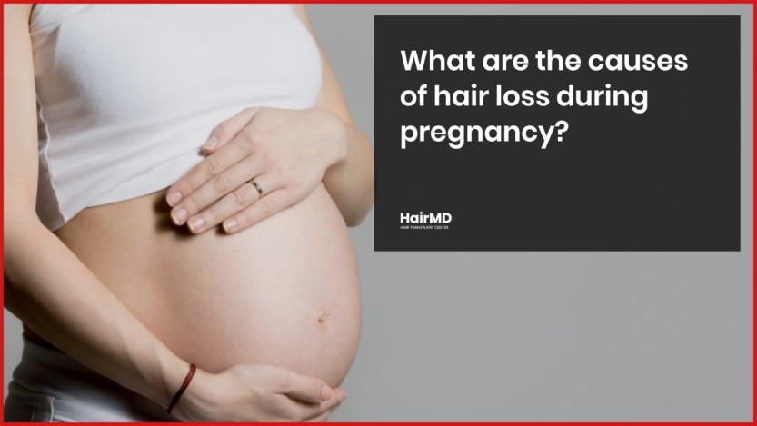 Reasons for hair fall post pregnancy which you need to address