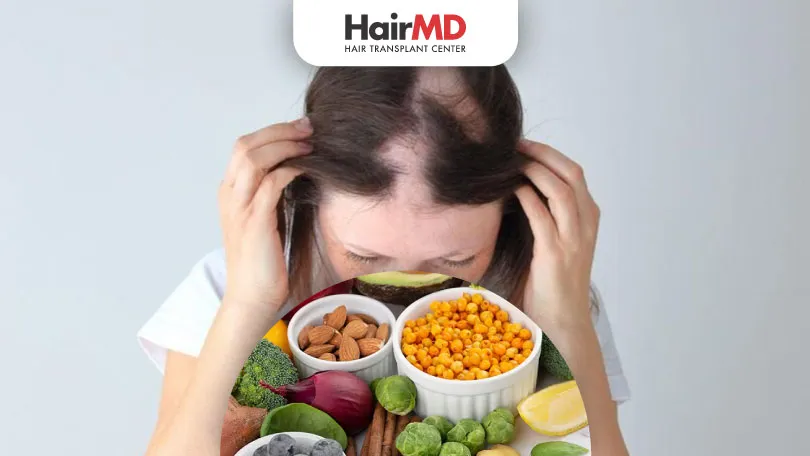 Alopecia Areata Diet: Essential Foods to Support Hair Growth and Scalp Health