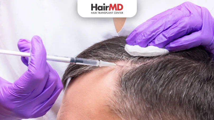 Benefits of Platelet Rich Plasma for Hair Loss