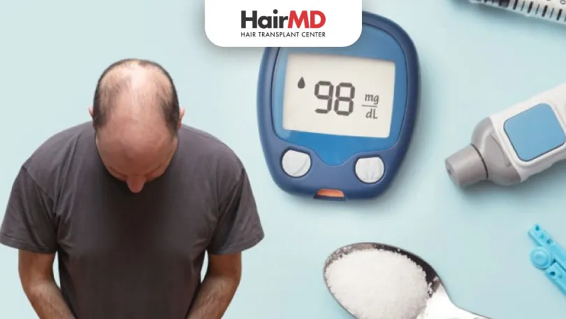 Can Diabetes Cause Hair Loss?