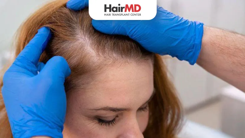 Hair Loss in Women: Causes & Treatments