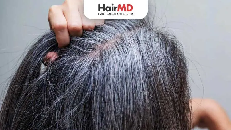 Grey Hair: Debunking Myths & Facts