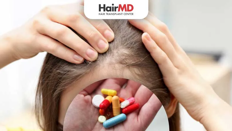 Top Medications for Hair Loss