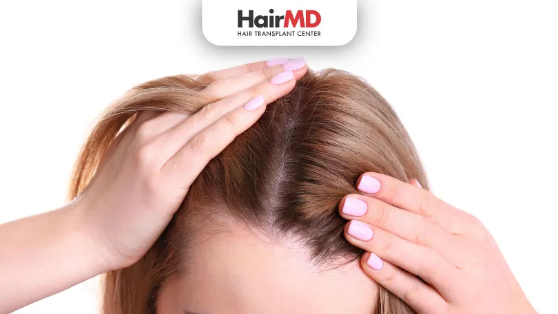 Aromatase Inhibitors: Do They Cause Hair Loss?