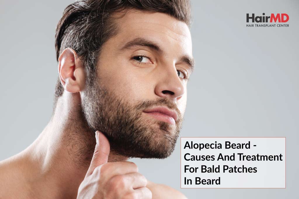 Update 75+ beard hair loss fungus best - in.eteachers