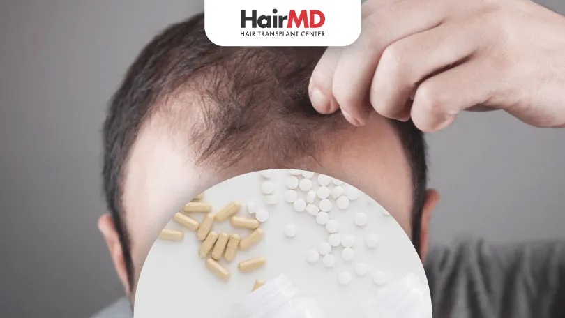 Does Chromium Picolinate Cause Hair Loss?