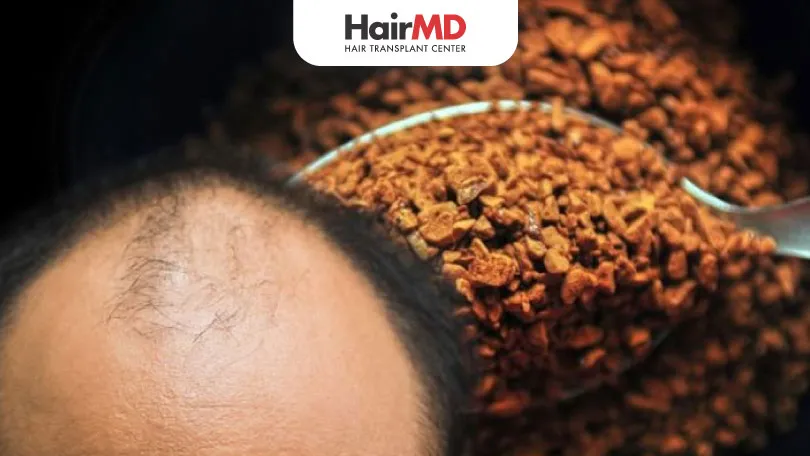 Does Caffeine Cause Hair Loss?