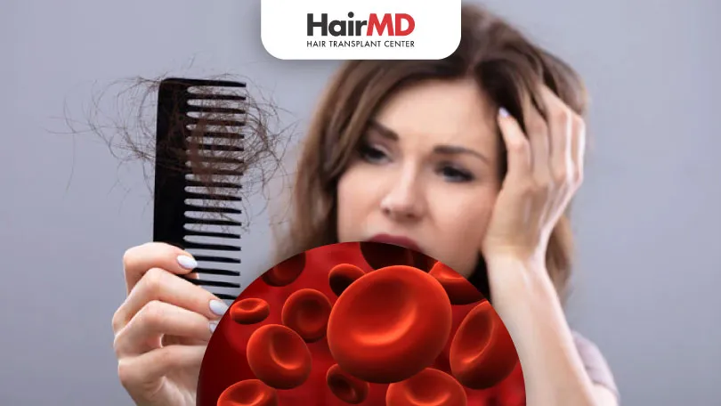 Does Iron Deficiency Cause Hair Loss?