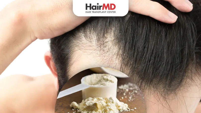 Does Protein Powder Cause Hair Loss?