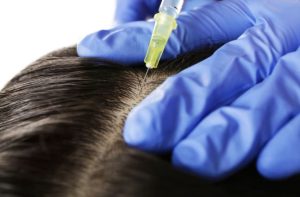 Best Scalp Treatments For Hair Growth - Platelet Rich Plasma Therapy