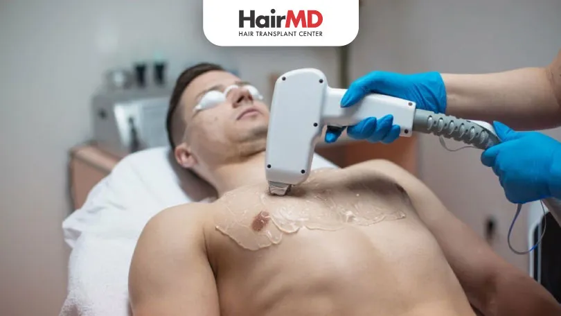 Everything you need to know about Laser Hair Removal HairMD Pune