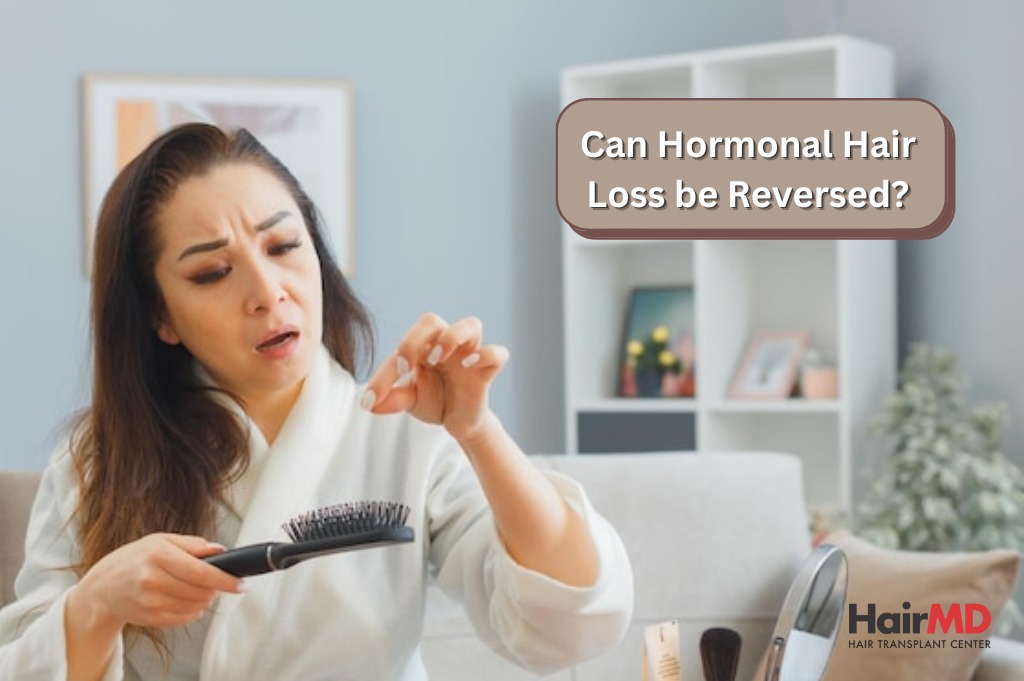 Can Hair Loss Be Reversed