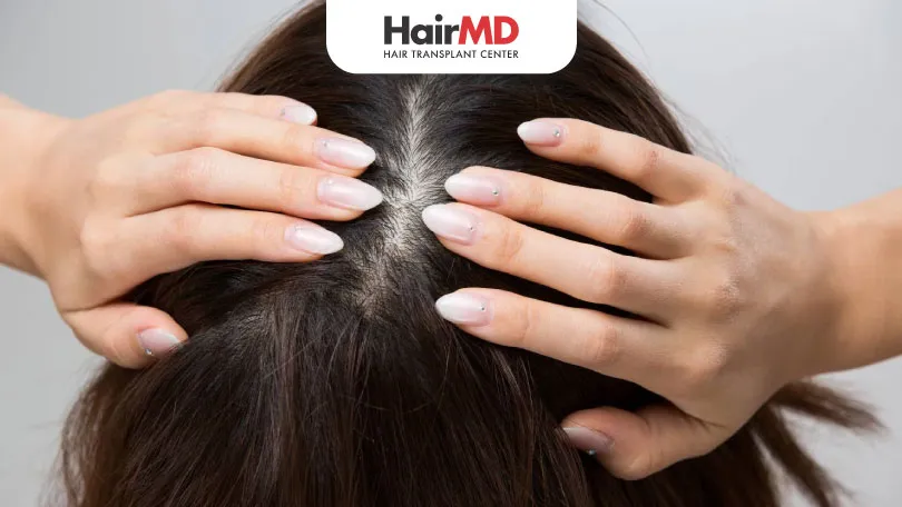 Is Hair Loss Due To Excessive Sweating Reversible HairMD Pune