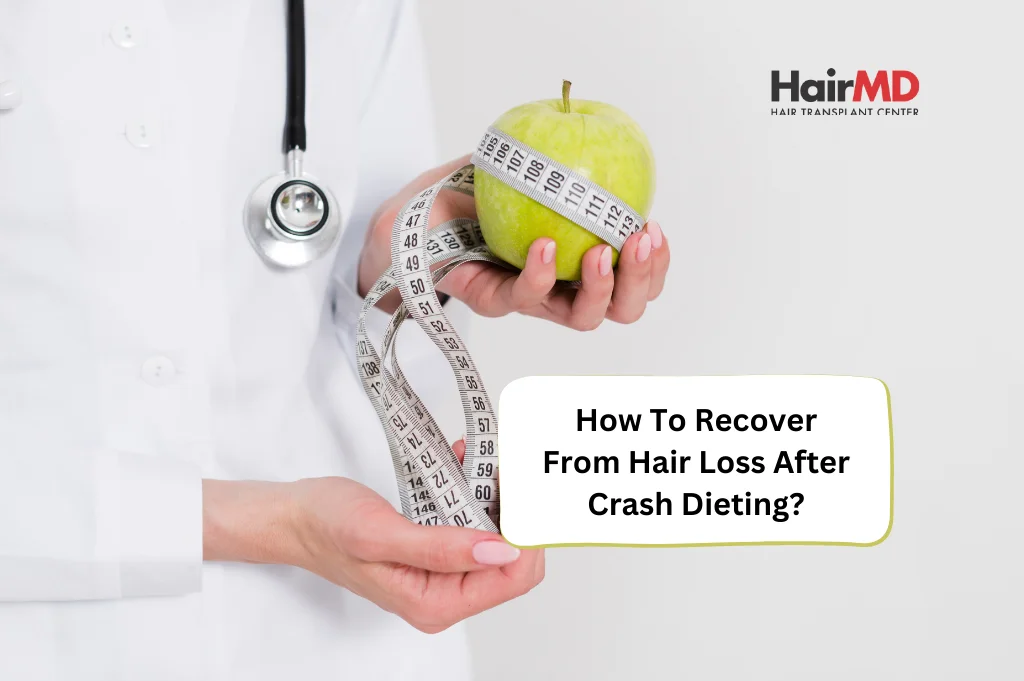 How to Recover from Hair Loss After Crash Dieting?