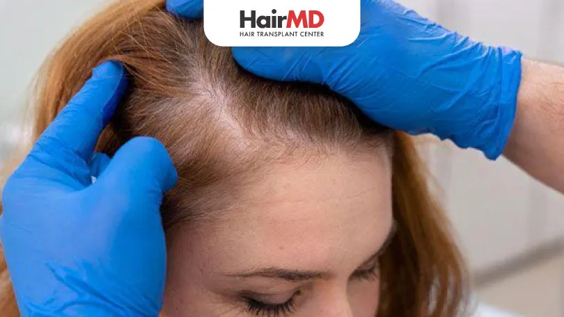 Illnesses Linked to Hair Loss: Understanding the Causes