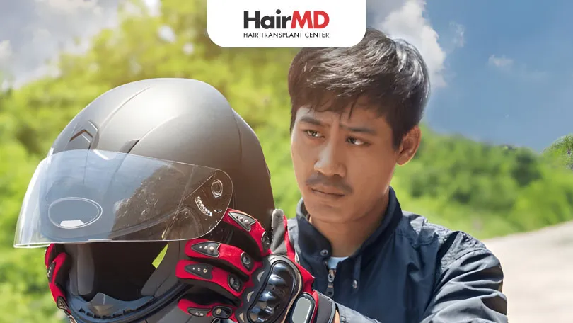 Helmet Use and Hair Loss: What You Need to Know?