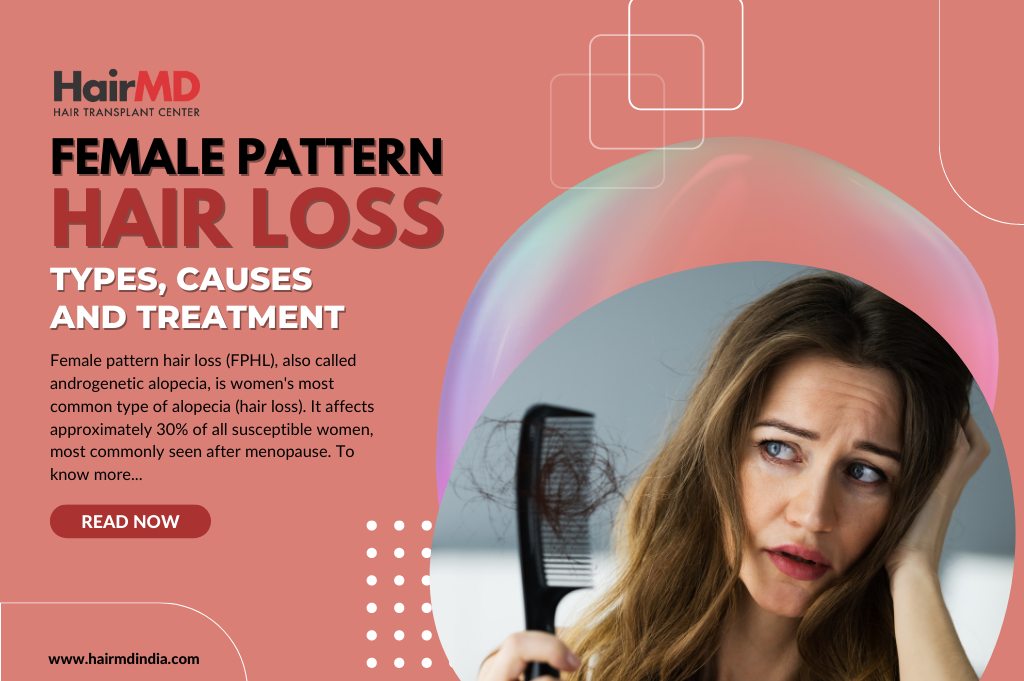 Female Pattern Baldness Causes And Treatment Options