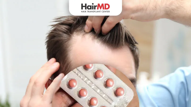 How Good is Finasteride for Hair Loss?