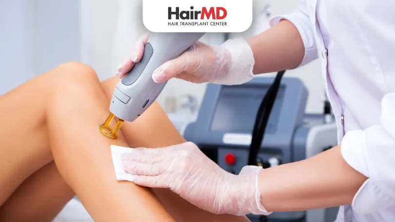 How Laser Hair Removal Works: The Guide to Hair