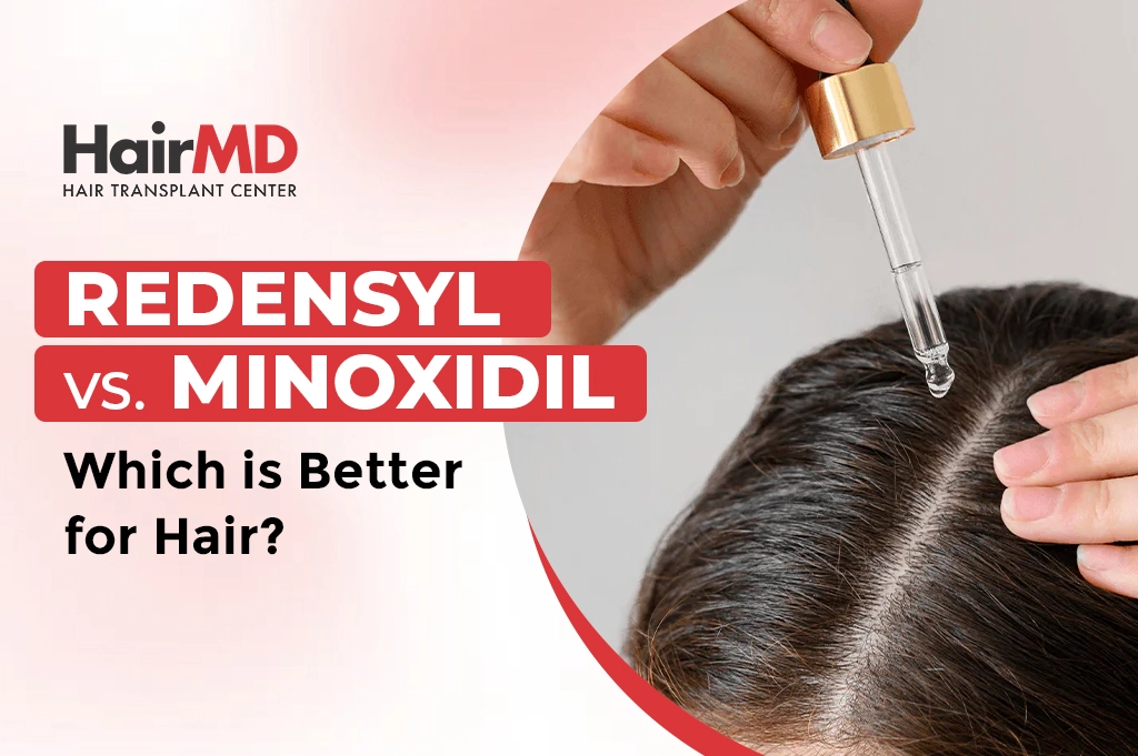 Redensyl vs. Minoxidil – Which is Better for Hair