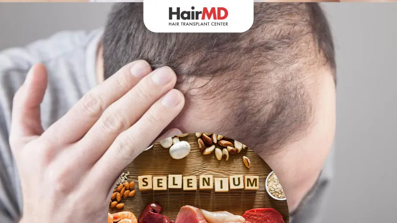 Selenium and Hair Loss: What You Need to Know