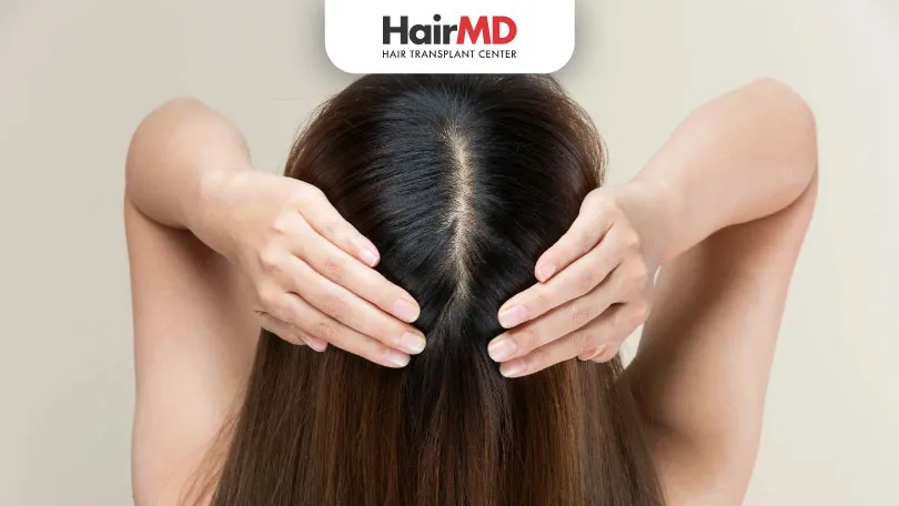 How To Maintain Healthy Hair Follicles HairMD Pune