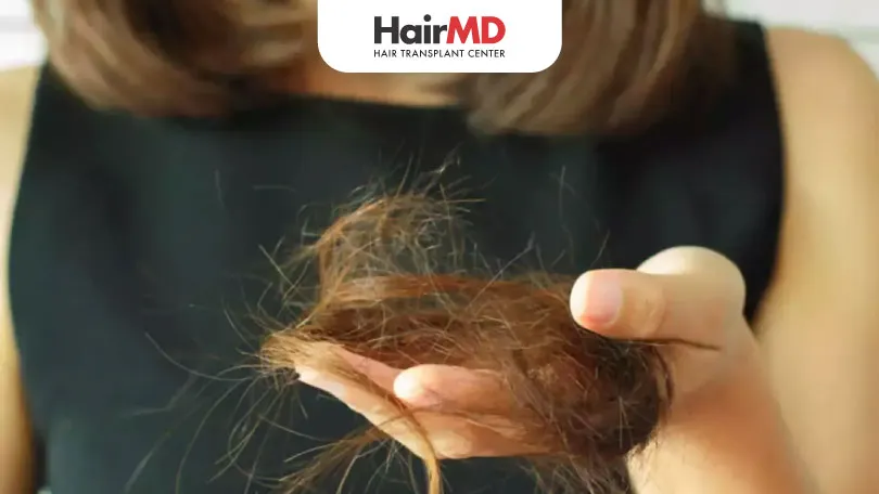 How to Recover from Hair Loss After Crash Dieting?