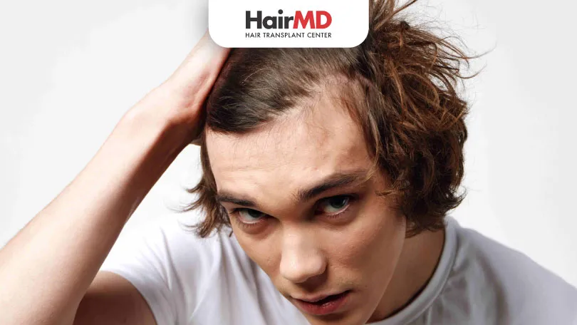 How to Stop Hair Loss in 20s: Causes, Treatments & Prevention for Men