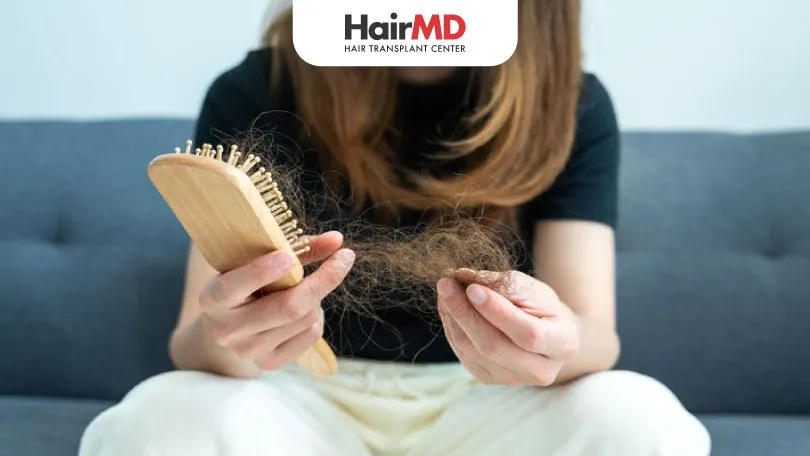 How to Treat PCOS Hair Loss ? – A Comprehensive Guide