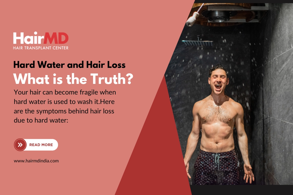 Debunking the Connection Between Hard Water and Hair Loss