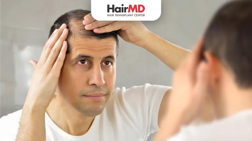 Manage Genetic Hair Loss: Effective Solutions You Need to Know