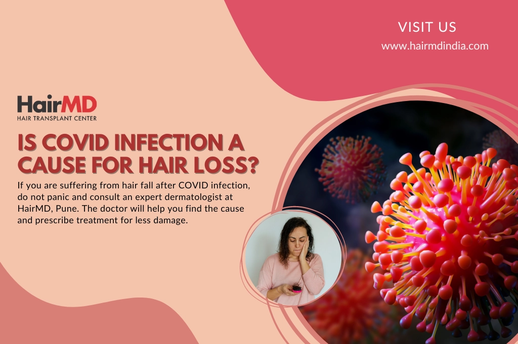 Is COVID Infection a Cause of Hair Loss