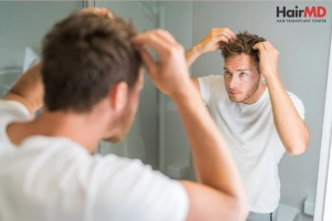 Is Hair Loss Due to Smoking Reversible?