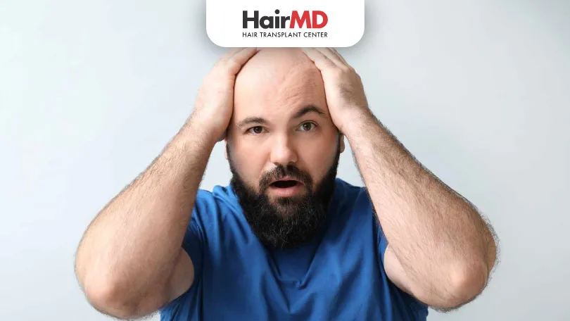 Is Obesity One of the Reasons for Hair Loss?