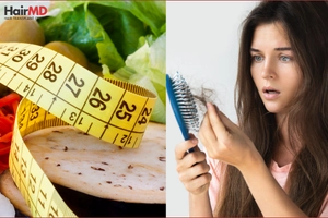 Prevention Tips for Reducing Hair Loss from Keto Diet