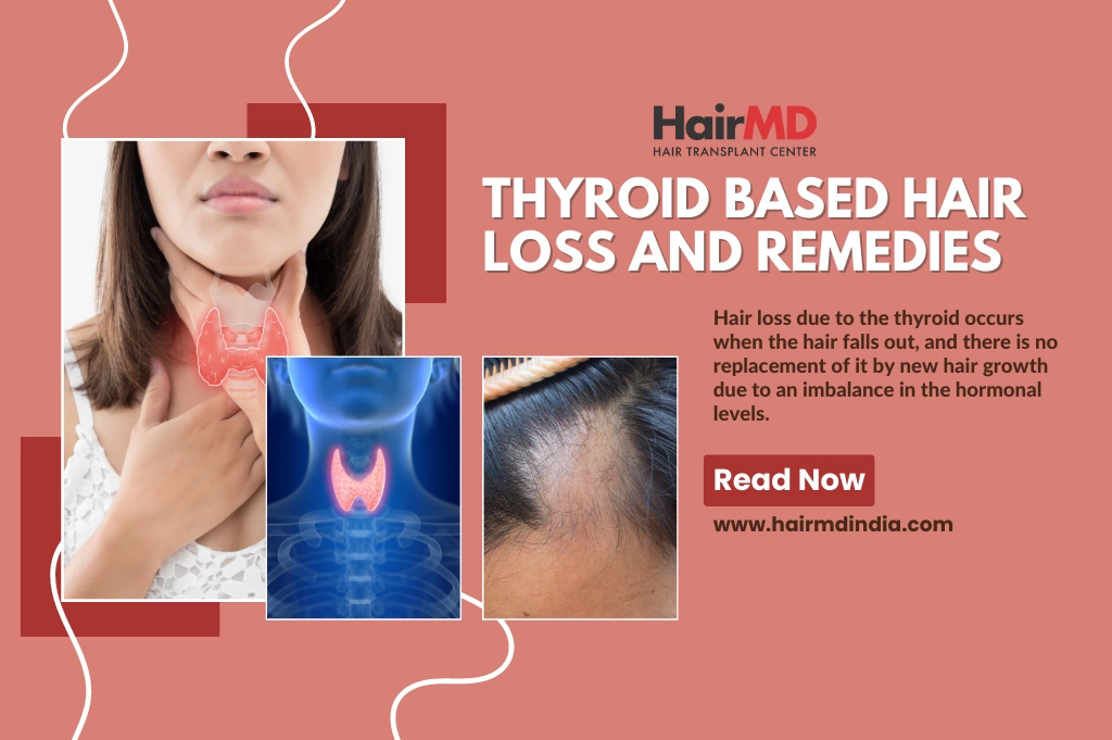 Thyroid hair loss remedies