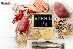 Vitamin B12 for Hair Loss