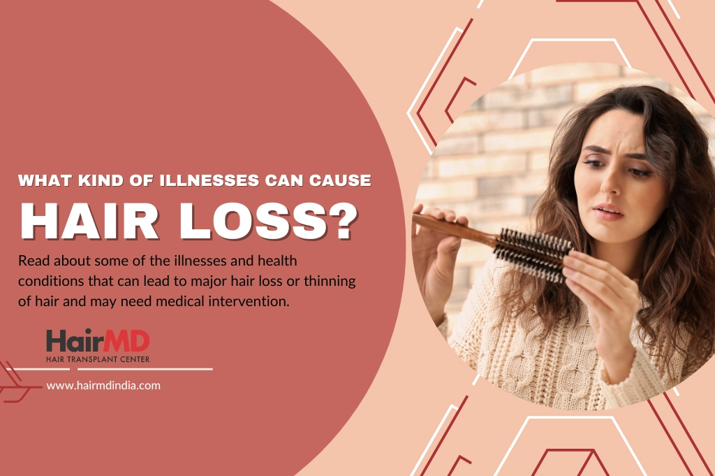 What Kind of Illnesses Can Cause Hair Loss?