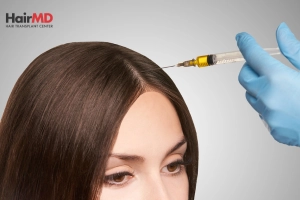 What is PRP Therapy for Hair Loss?