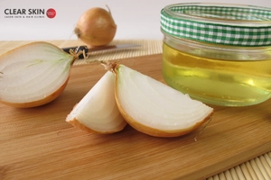 How to Use Onion Juice for Hair Fall Treatment?