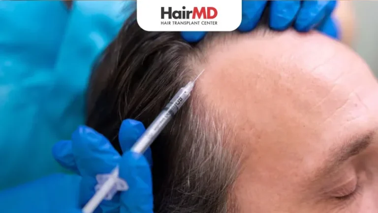 Mesotherapy vs PRP for hair Which is better for Hair Loss HairMD Pune